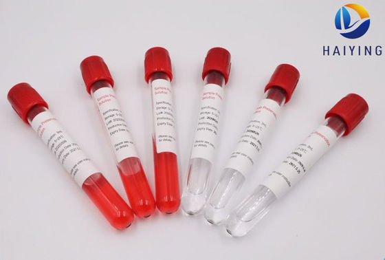 ห้องปฏิบัติการตัวอย่างหลอดทดลองของกรดนิวคลีอิก
